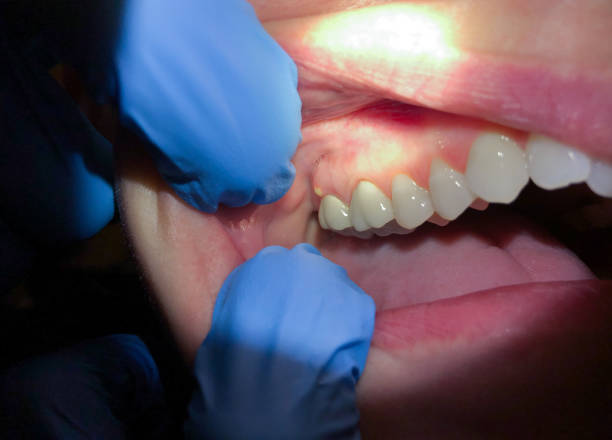 Best Emergency Dental Surgery in Lookout Mountain, TN
