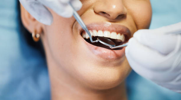 Best Emergency Tooth Extraction in Lookout Mountain, TN